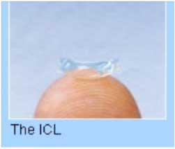 What-is-an-Implantable-Contact-Lens-(ICL)-