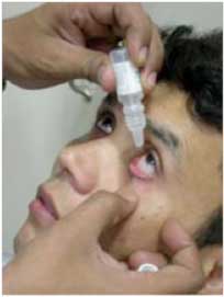 _HOW-TO-USE-EYE-DROPS--